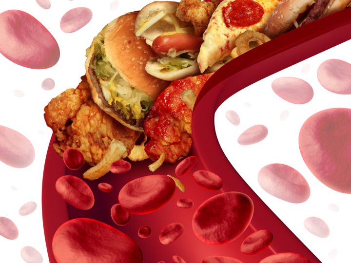 Sociedade Brasileira de Cardiologia aperta o nó e reduz os índices de normalidade para o colesterol