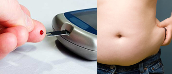 Redução de estômago pode ajudar pacientes com diabetes